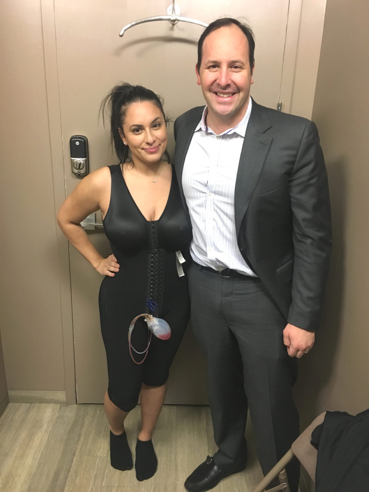 One of Dr. Zuckerman’s tummy tuck and buttock augmentation patients. She is wearing a postoperative compression garment and has her surgical drains.