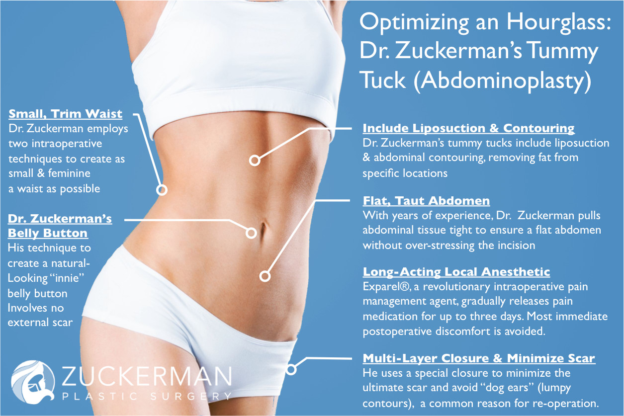 All about tummy tuck scars - Hourglass Tummy Tuck