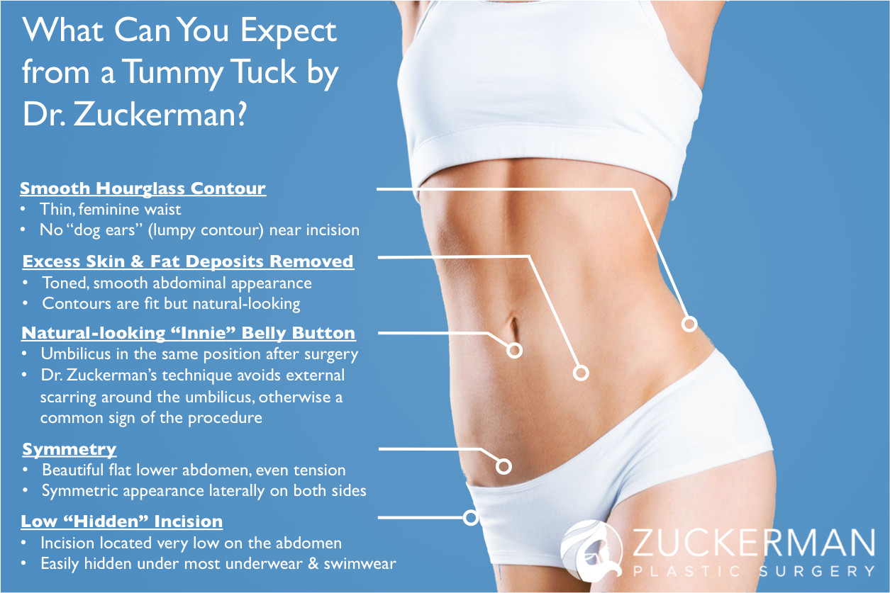 what can you expect tummy tuck infographic