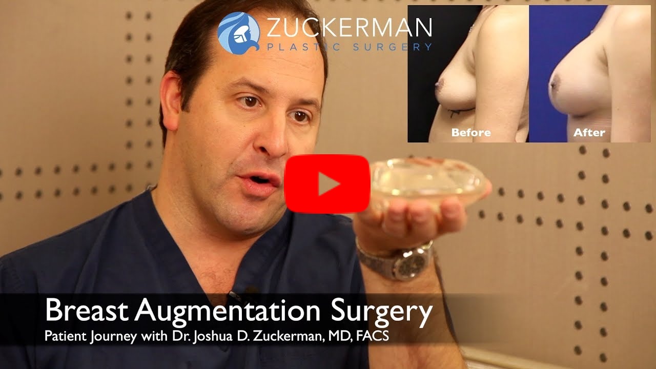 Thumbnail of YouTube video 'Breast Augmentation Patient Journey - Zuckerman Plastic Surgery' with play button